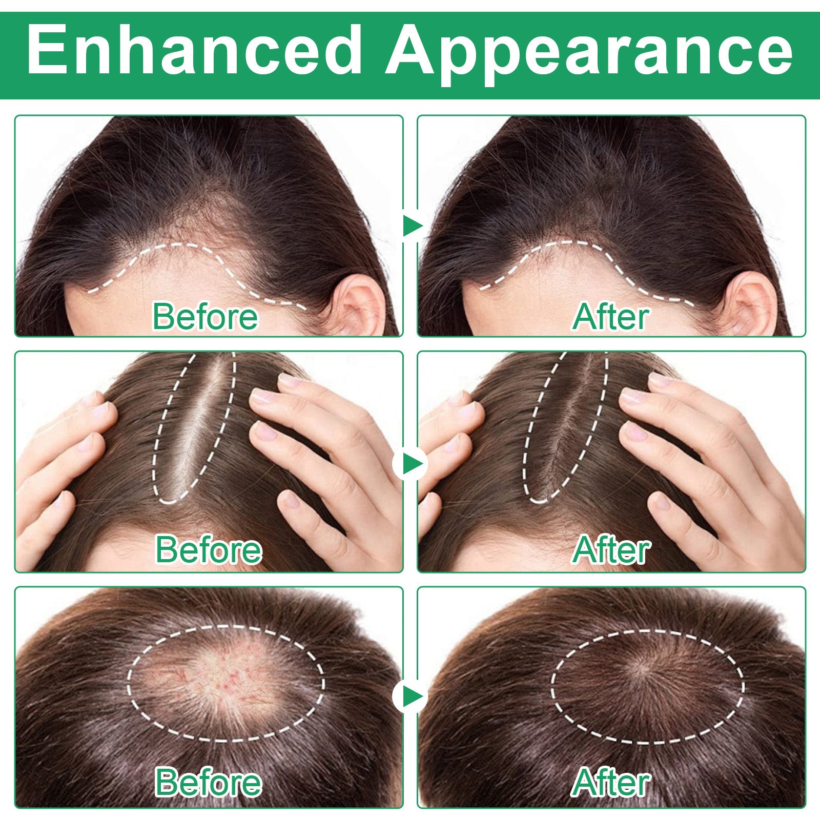 Follicle Renewal Serum